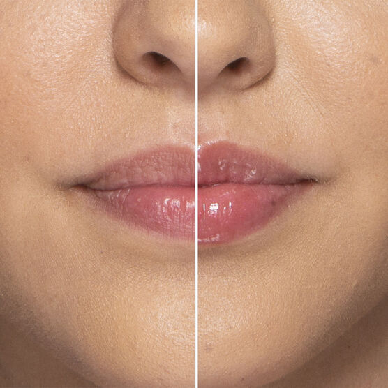 LIP INJECTION 1.5GR